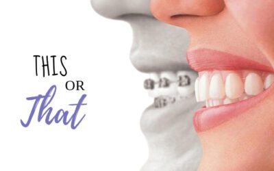 The Benefits Of Invisible Braces