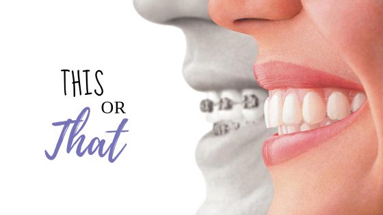 The Benefits of Invisible Braces