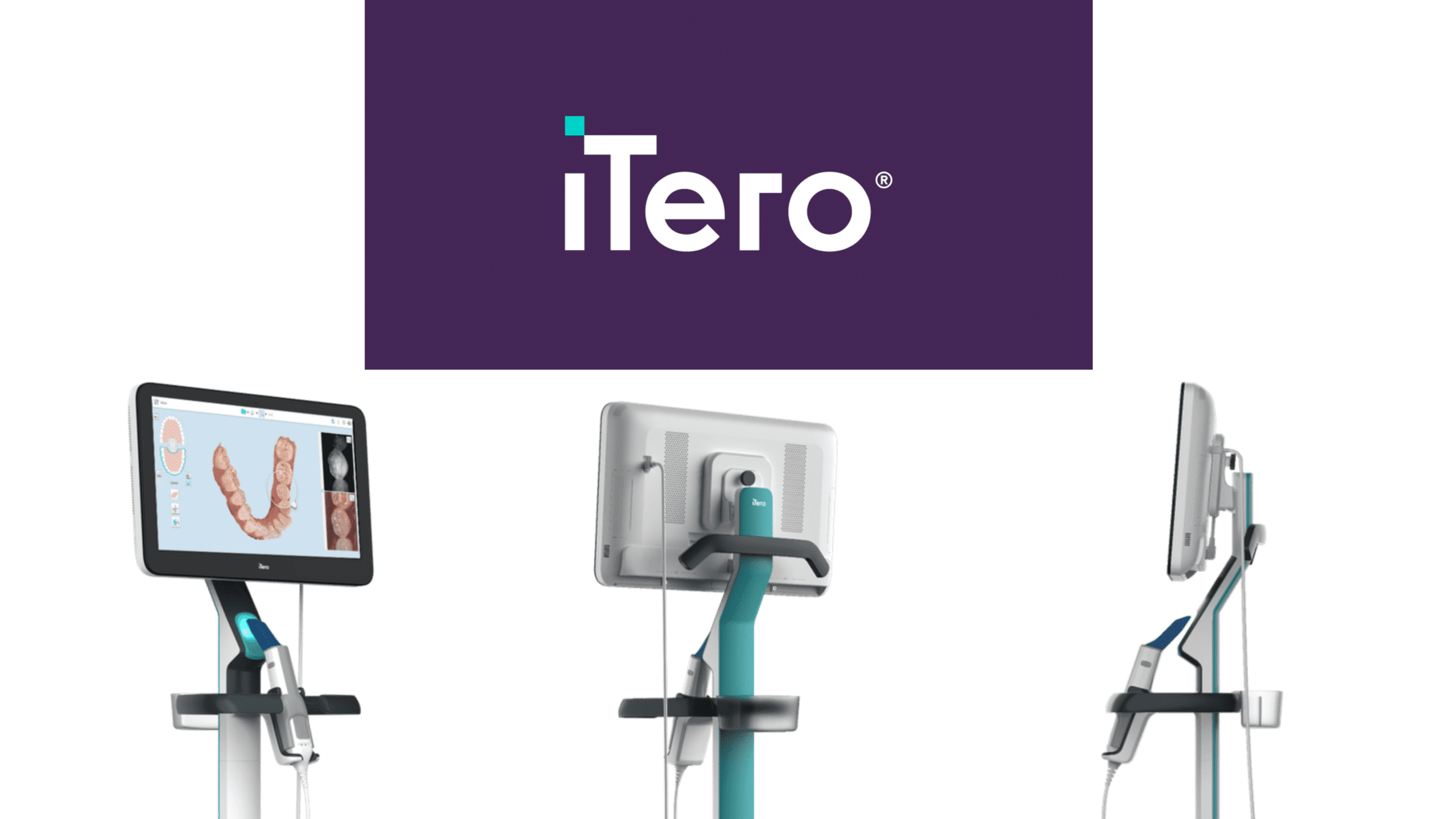  Itero Intraoral Scanners