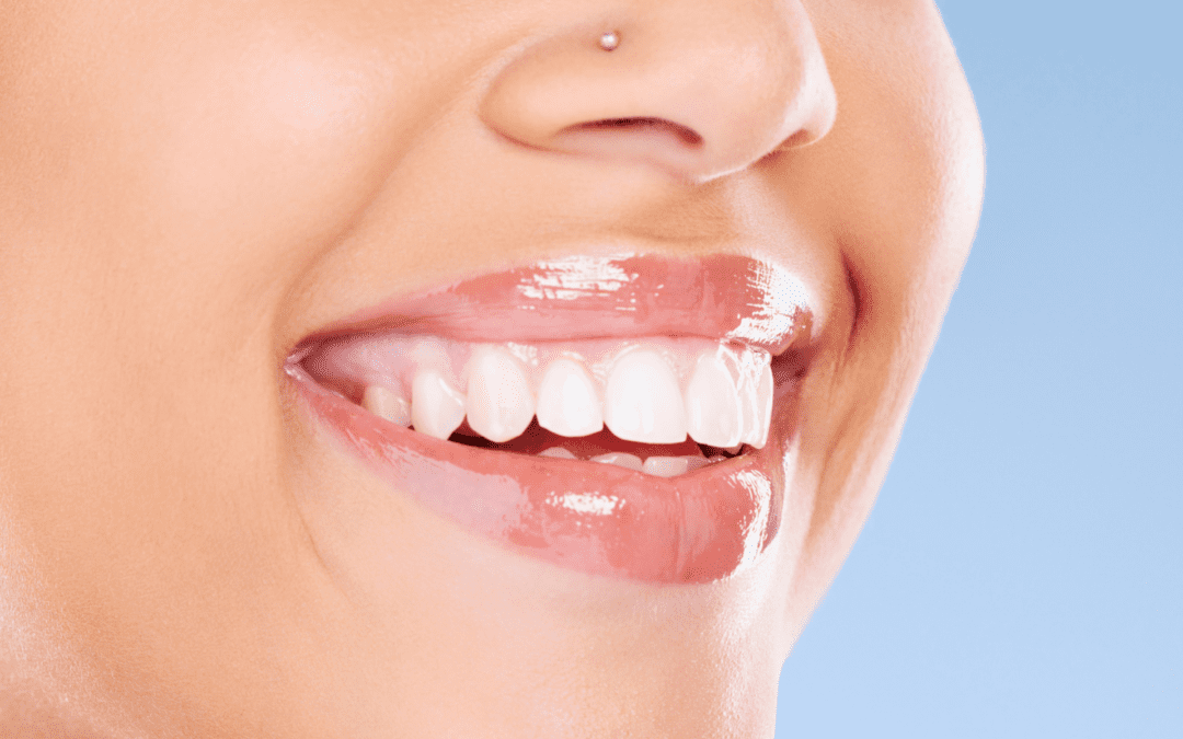 Auckland Dental Care | Your Guide to Optimal Oral Health – Dominion Dental